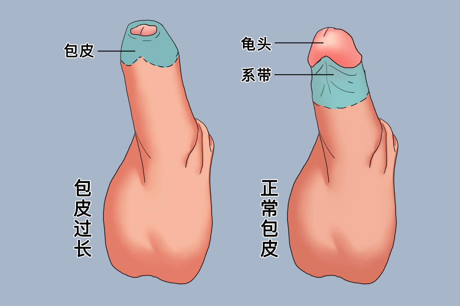 探索男性生理奧秘，包皮的正常形態(tài)解析，男性生理奧秘探索，包皮正常形態(tài)解析