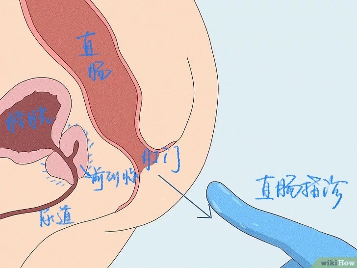 關(guān)于前列腺按摩的正確方法與部位，前列腺按摩的正確方法與部位詳解