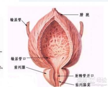 治療前列腺炎的最佳方法，治療前列腺炎的最佳方法解析