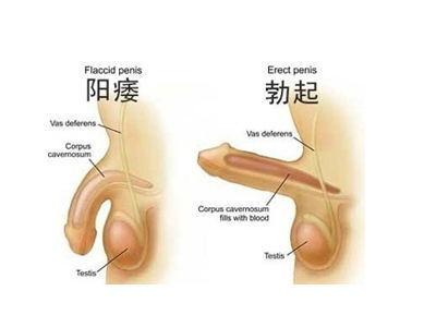 前列腺炎的治療與藥物治療方案，前列腺炎的治療及藥物治療方案詳解