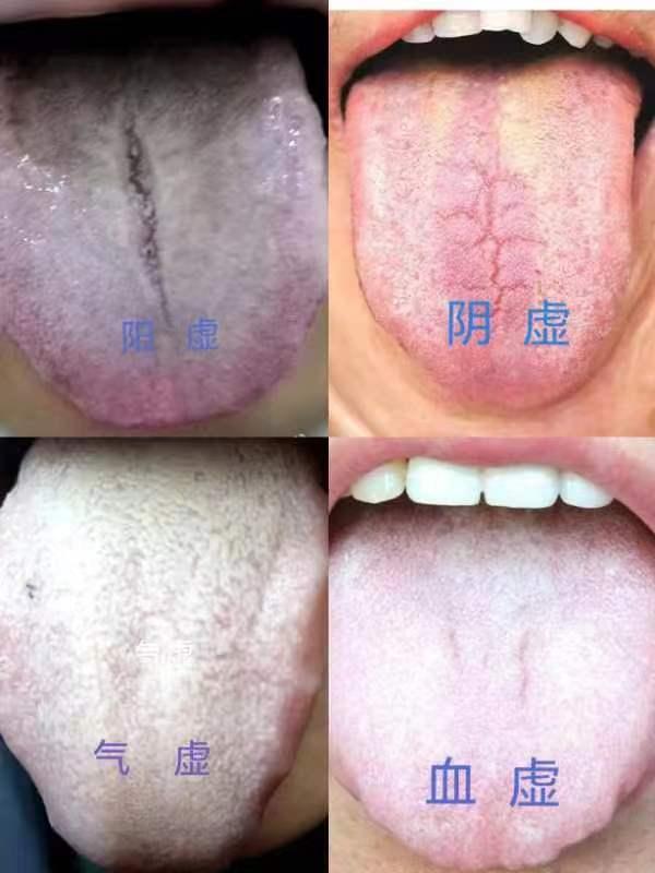 男性腎陽(yáng)虛的癥狀及其影響，男性腎陽(yáng)虛癥狀與影響概述