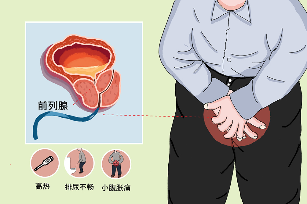 前列腺炎的緩解方法，了解、預(yù)防與改善，前列腺炎緩解方法，了解、預(yù)防與改善措施